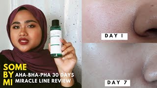 SOMEBYMI AHA·BHA·PHA 30 DAYS MIRACLE LINE • 7 DAYS • REVIEW