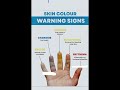 skin colour warning signs #viralshort #shortsfeed #hospital #medicine #trending #dactor #knowledge