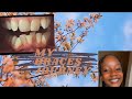 MY BRACES JOURNEY -2 years of braces transformation | Namibian YouTuber