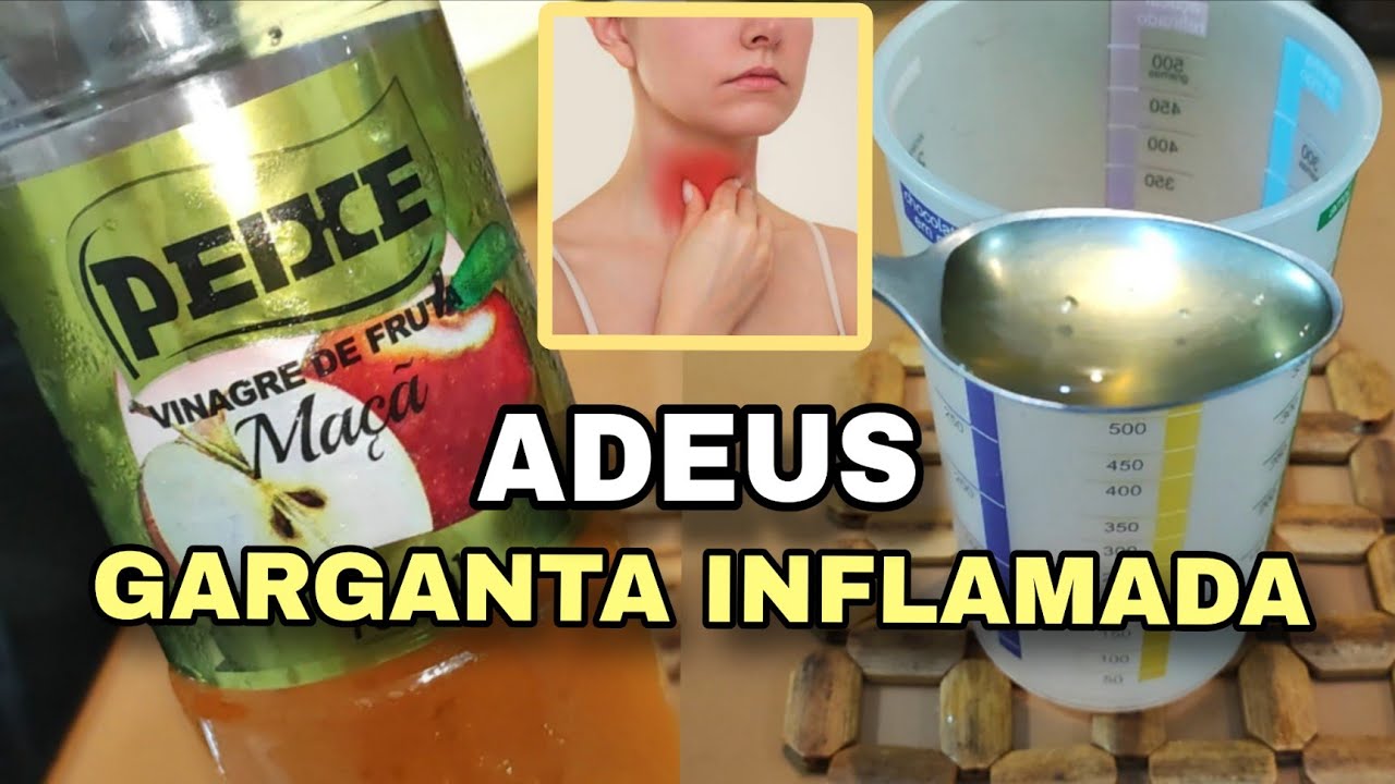 REMÉDIO CASEIRO PARA GARGANTA INFLAMADA / FÁCIL, BARATO E NATURAL - YouTube