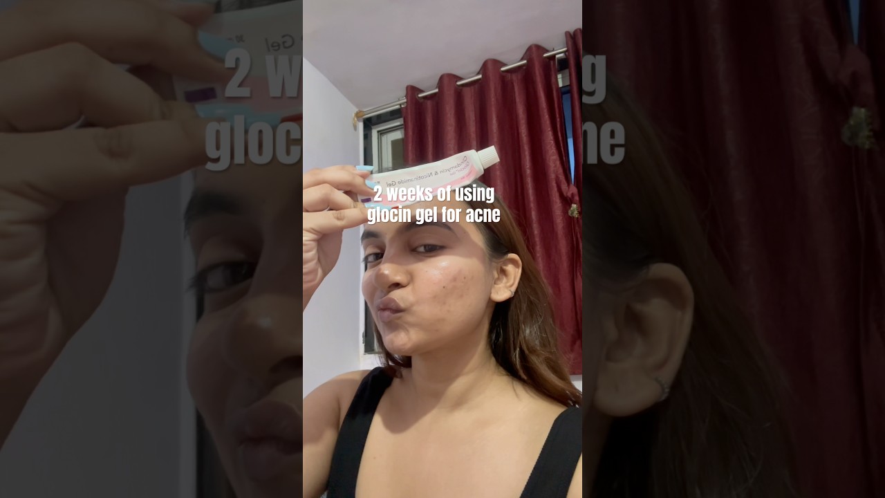 Using glocin clindamycin & Nicotinamide gel for acne 
