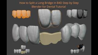How to Split a Long Bridge in B4D Step by Step  Blender for Dental Tutorial