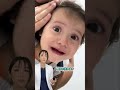 【赤ちゃんの鼻うがい】 大量に出て止まらない！溜まってた膿性鼻汁が止まらない#shorts