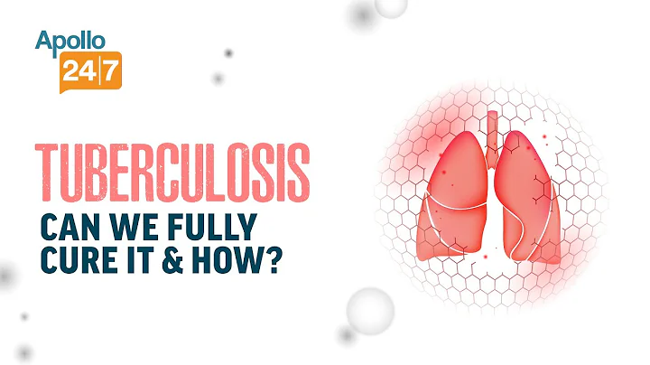 Tuberculosis - Can We Fully Cure It & How? | Apollo 24|7 Health Hour | Apollo 24|7 Experts - DayDayNews