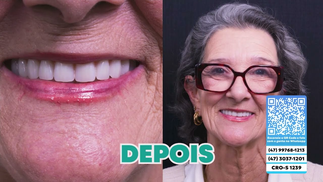 Segurança e Conforto: Dr. Werner fala sobre procedimentos na Spazio Dental
