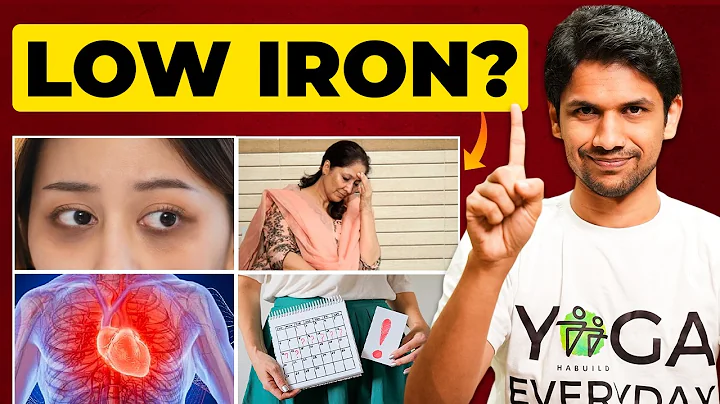 8 Signs of Iron Deficiency on our Body | Best Sources of Iron | Saurabh Bothra