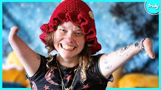 No Hands Or Elbows But Still Found True Love | BORN DIFFERENT Wealth