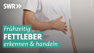 Fettleber  auch Schlanke betroffen | Doc Fischer SWR