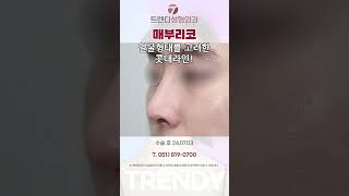 울퉁불퉁한 매부리코, 깎기만 하면 될까? #매부리코 #코성형 #부산코성형