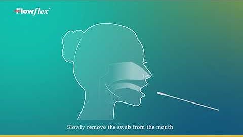 Monkeypox Virus Antigen Rapid Test Kit