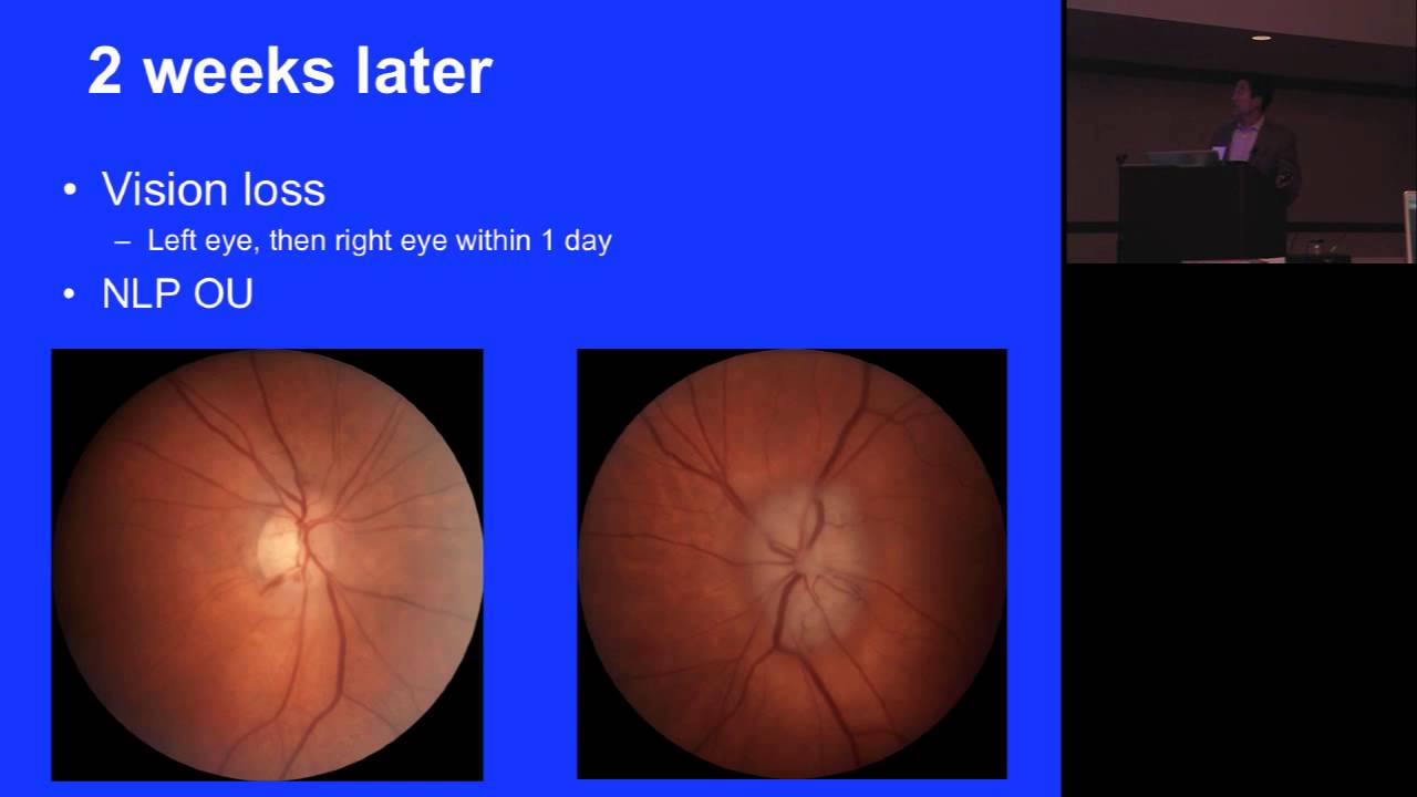 Key Issues in the Diagnosis and Management of GCA
