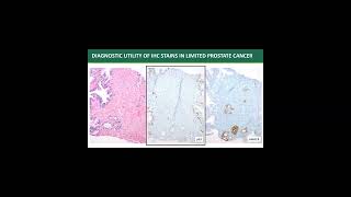 Pathoradiological corr cases prostate