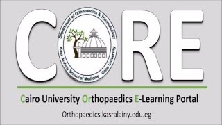 Workshop Abou El ReeshIlizarov Frame for treatment of Clubfoot