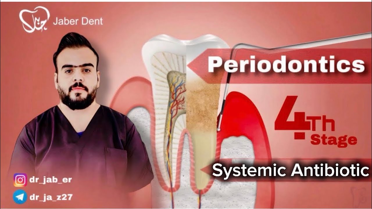 Periodontics _( Systemic Antibiotic )