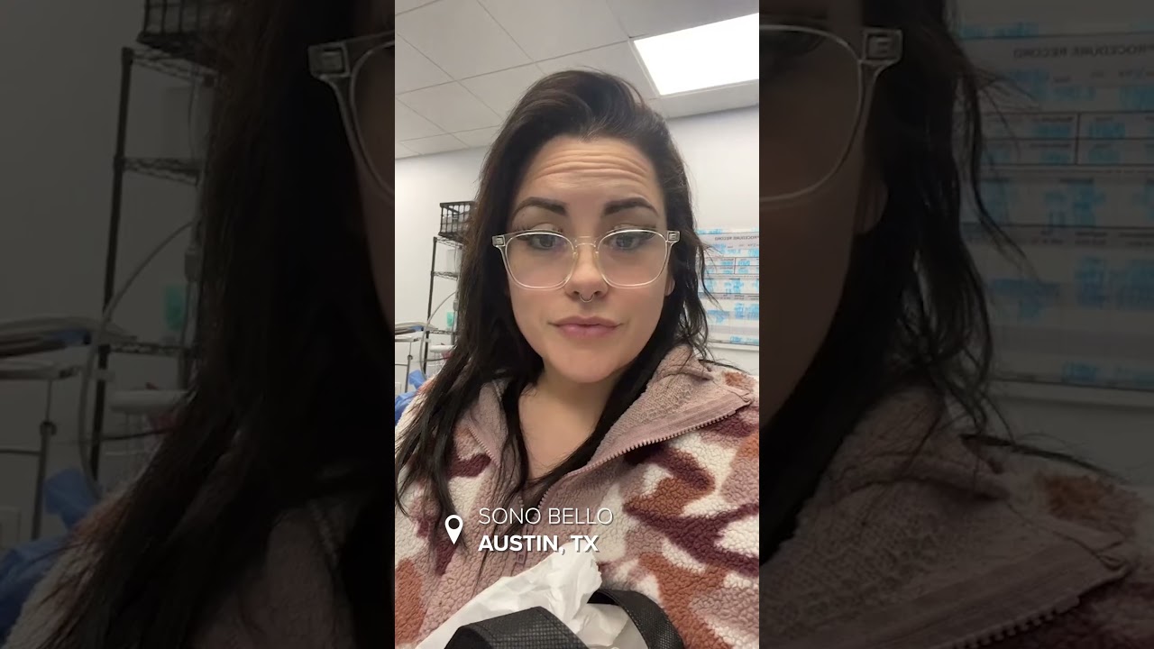 Kristen's AbEX Tummy Tuck Alternative Journey | 1 Mo. Tummy Tuck Alternative Results with Sono Bello