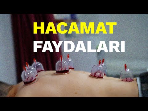 Hacamat Faydaları