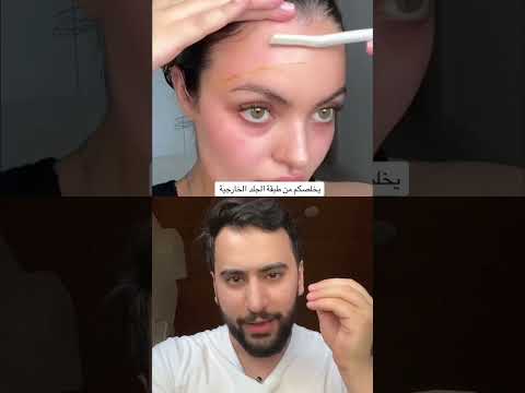 فيديو: هل يمكن إزالة شعر الوجه؟