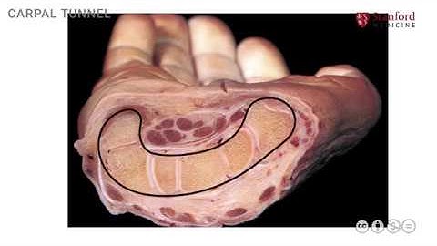 Anatomy of the Upper Limb: Carpal Tunnel