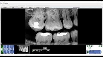 Training: Apteryx XVWeb: Capturing Additional Images in XVCapture