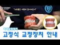 치아 교정장치 (고정식 교정장치)