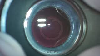 Capsulaser - Escrs Paris 2019 - Dr Pavel Stodulka