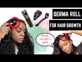 NO MINOXIDIL: NATURALLY STOP ALOPECIA, HAIR LOSS, HAIR THINNING WITH DERMA ROLLER AND HERBAL OIL