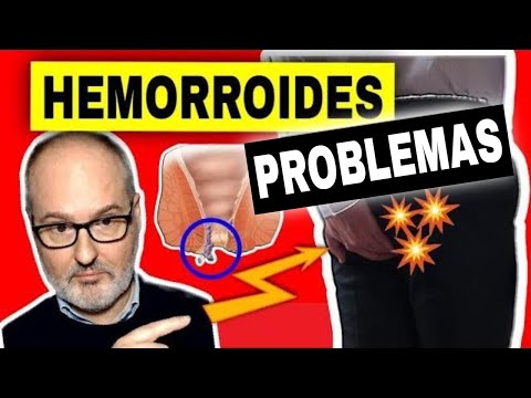 Vídeo: Les hemorroides externes poden ser de color carn?