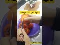 فاكهة الغيبة المحرمة 