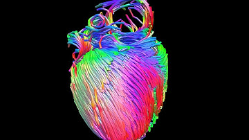 MRI diffusion tensor imaging of the heart