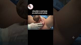 Normal Vaginal Delivery | Realistic Childbirth Medical Animation #Normal delivery #babydelivery