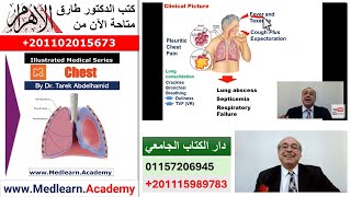 Pneumonia (I)  #cme #internal_medicine #medical #usmle #محاضرات_باطنة screenshot 2
