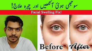 How to Get Rid of Dark Circles - 7 Pro Tips and Natural Remedies (Urdu/Hindi)