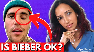 Eye Doctor Explains Justin Bieber