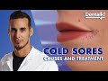 Do you have COLD SORES? TREATMENT and CAUSES of the herpes virus on LIPS | Dentalk! ©