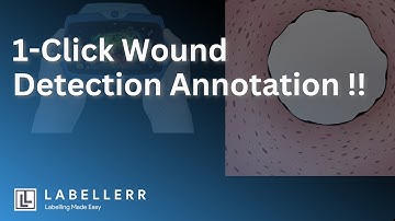 One-Click AI Wound Detection with Labellerr’s SAM: Recover Fast