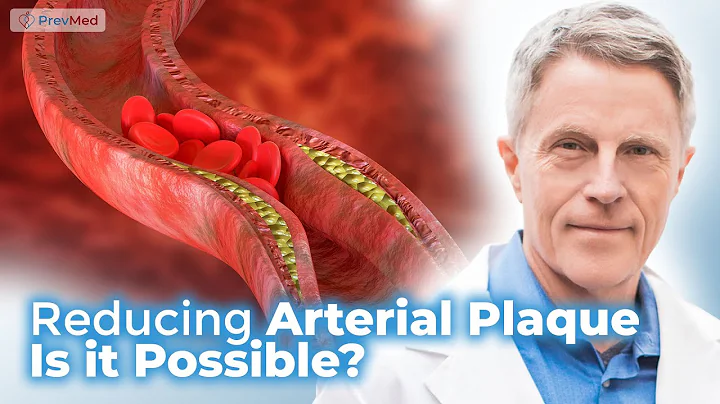 Reducing Arterial Plaque - Is it Possible? - DayDayNews