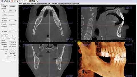 Invivo™ 5.4.5 Training Series: Introduction to the Section View Tab