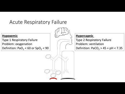 Acute Respiratory Failure