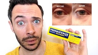 Preparation H for Puffy Eyes I Used It for Bags Heres What Happened