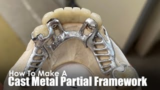 How To Make A Cast Metal Partial Framework | FULL PROCESS | Study & Learn