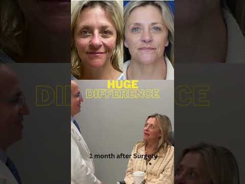 Video thumbnail: It's Exactly what my Face Needed! | Beautiful Female Rhinoplasty! | Before+ After · Ali Sajjadian
