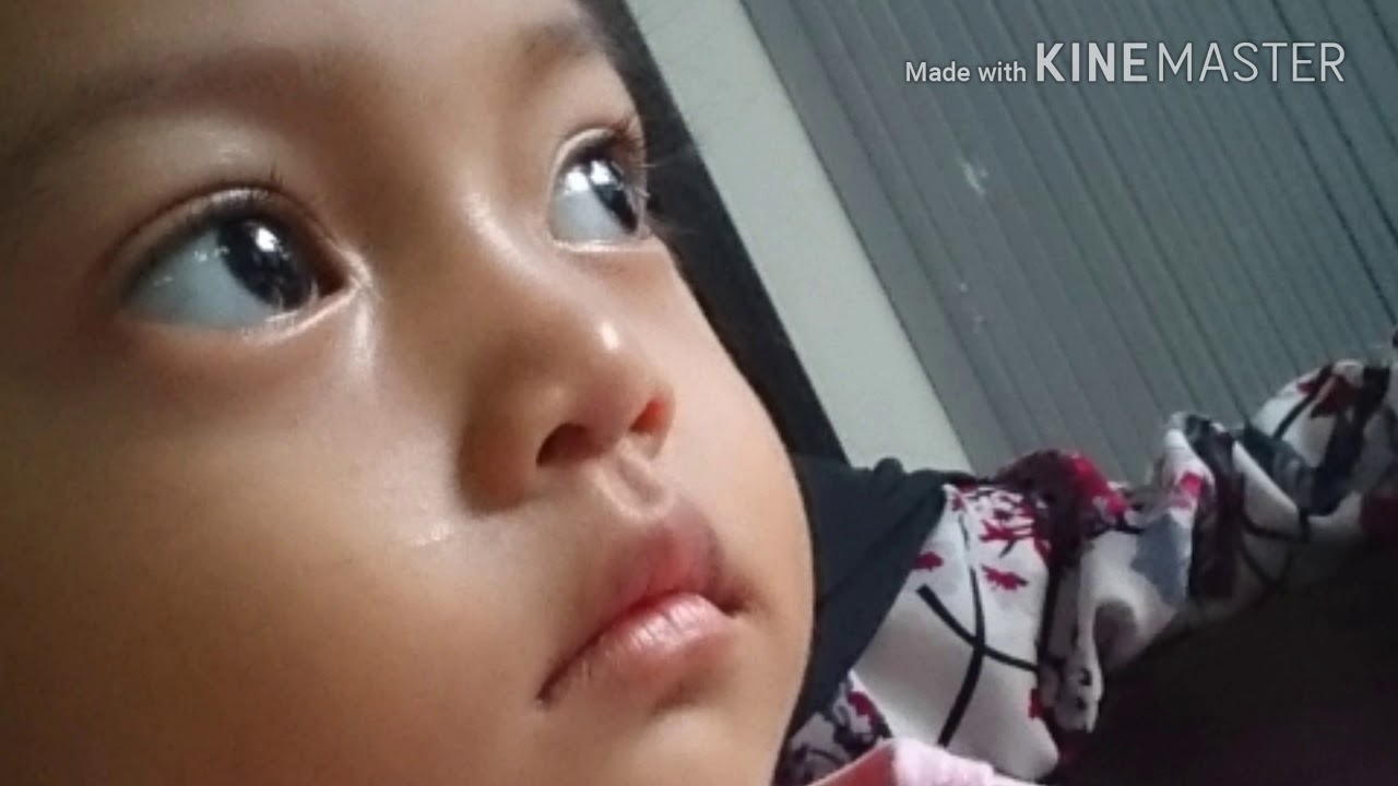 Otitis Media Akut Atau Oma Infeksi Telinga Youtube