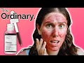 3 Things I Wish I Knew Before Trying The AHA 30% BHA 2% Peeling Solution From The Ordinary