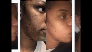 2- Month CUROLOGY Update: Does It Work? | Conquering Asya