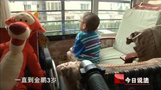 今日说法 《今日说法》 20110810 患怪病的孩子