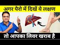 Never ignore these 9 warning signs of liver disease that come in your feet  healthy hamesha
