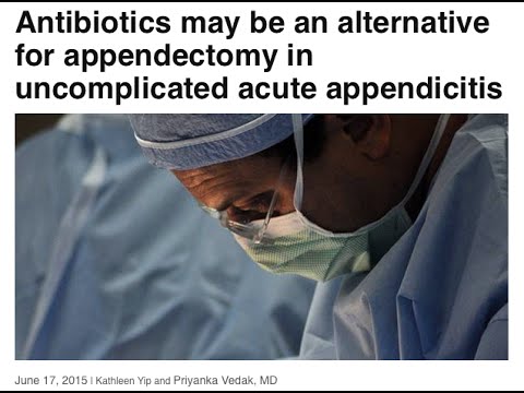 Appendicitis Non Surgical Approach To Treatment Youtube