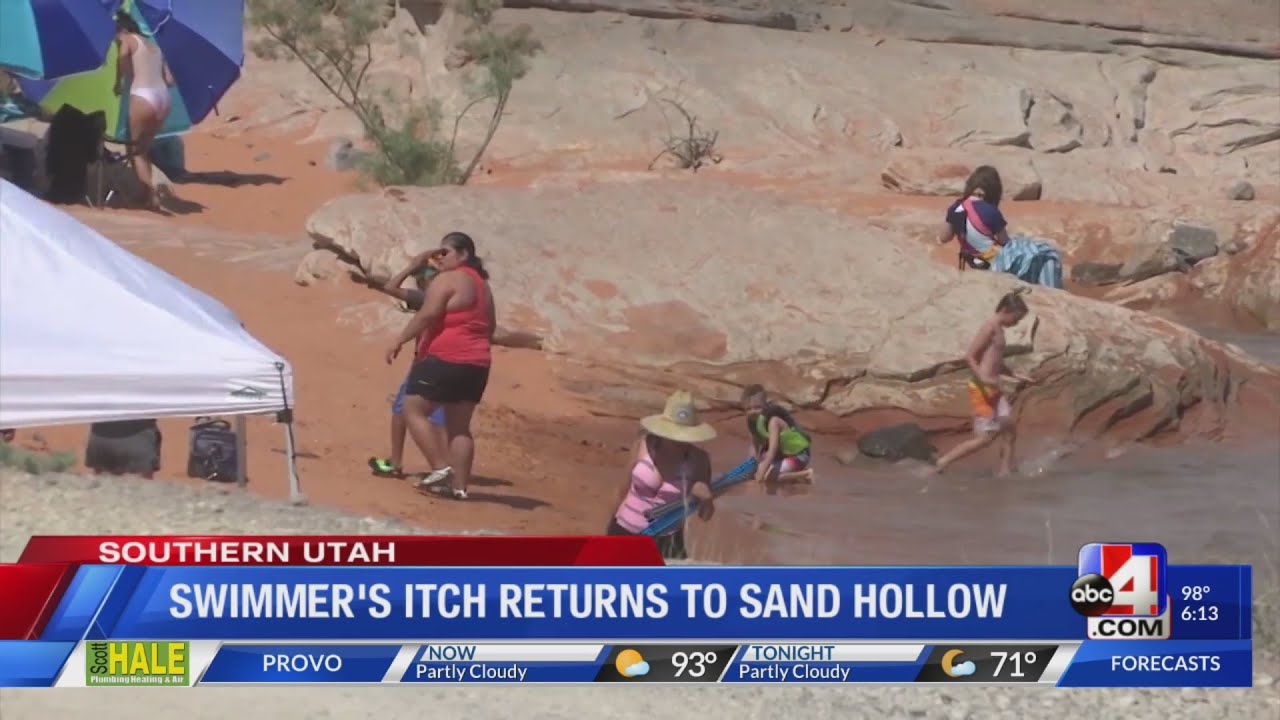 Does Sand Hollow Have Swimmer'S Itch Right Now?