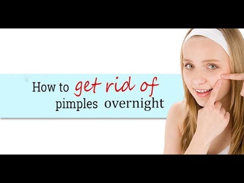 How To Get Rid of Pimple Overnight | DIY Pimple Remover - YouTube