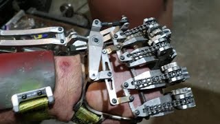 MECHANICAL ENGINEER BUILDS HIS OWN PROSTHETIC HAND! 🔥🦾